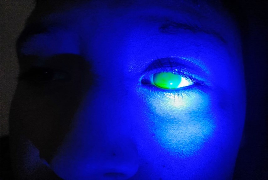 Lentes de contacto especializados